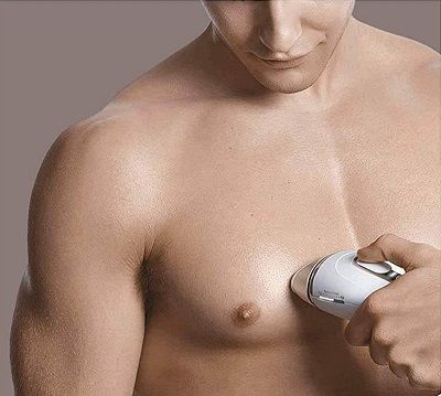 depilacion laser hombre